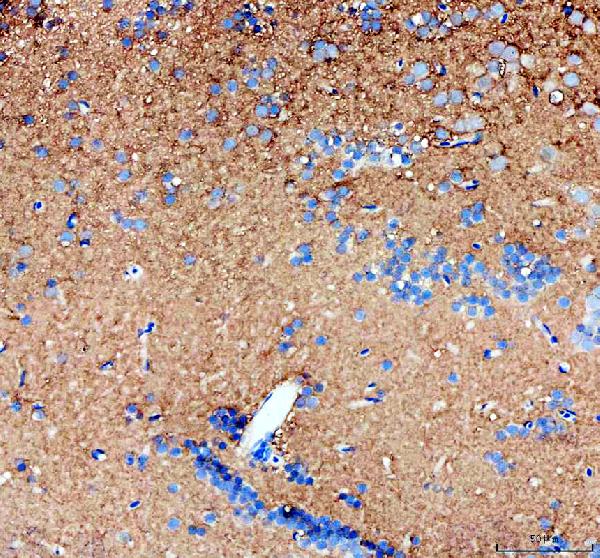  IHC analysis of Gpr179 using anti-Gpr179 antibody (DZ41643)