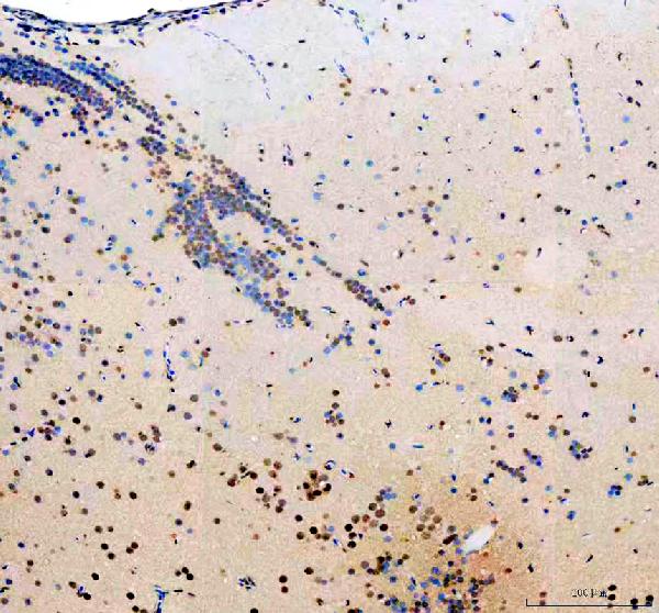  IHC analysis of Anp32e using anti-Anp32e antibody (DZ41646)
