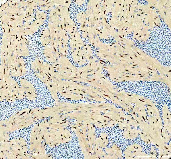  IHC analysis of Anp32e using anti-Anp32e antibody (DZ41646)