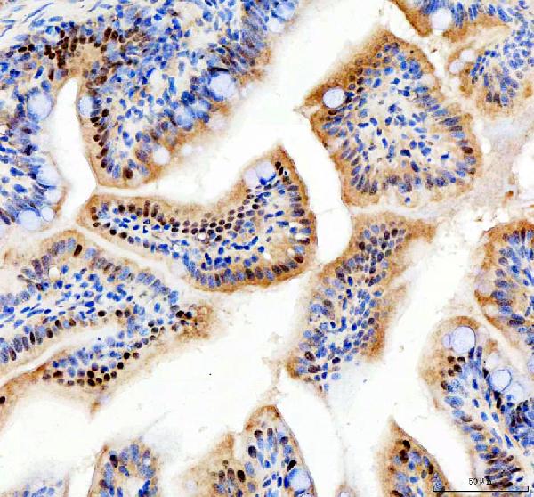  IHC analysis of Anp32e using anti-Anp32e antibody (DZ41646)