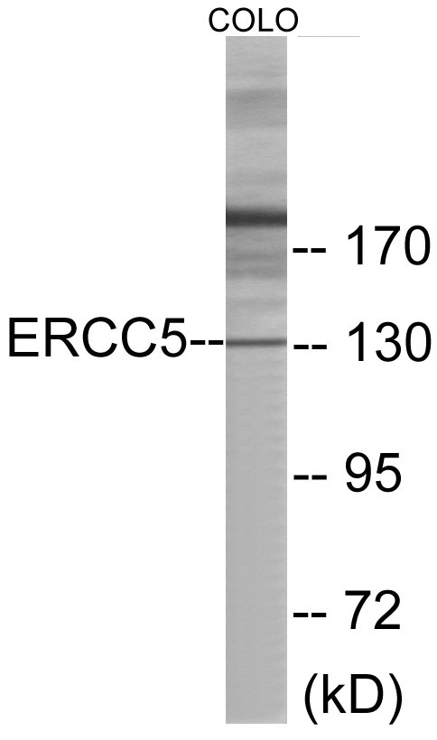 Western blot analysis of extracts from COLO cells