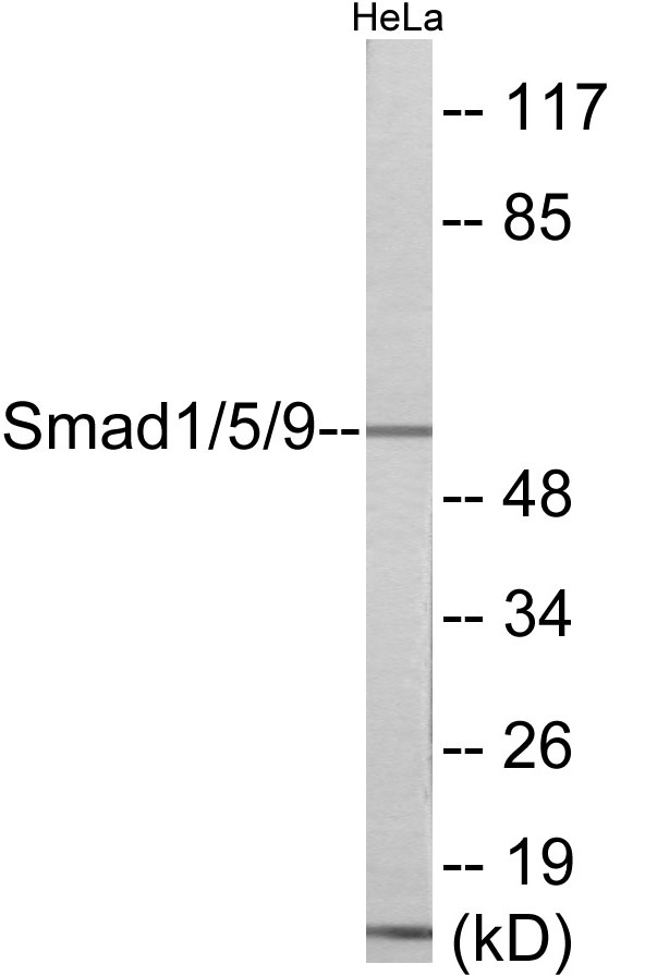 Western blot analysis of extracts from HeLa cells