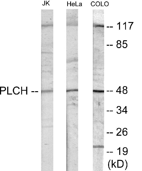 Western blot analysis of extracts from Jurkat cells/COLO205 cells/HeLa cells/HuvEc cells Western blot analysis of extracts from Jurkat cells/COLO205 cells/HeLa cells/HuvEc cells
