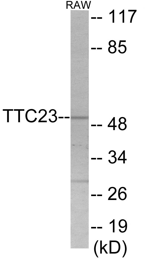 Western blot analysis of extracts from RAW264.7 cells