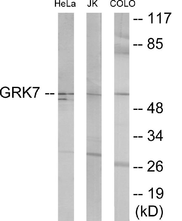 Western blot analysis of extracts from COLO205/Jurkat/HeLa cells