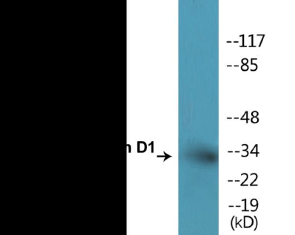 Western blot analysis of extracts from Jurkat cells treated with EGF 200ng/ml 30