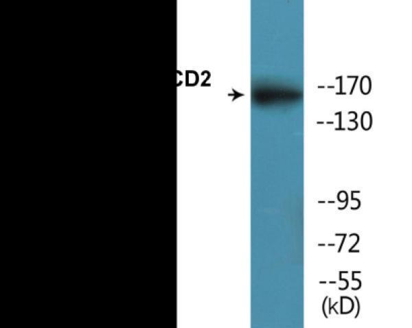 Western blot analysis of extracts from HT29 cells treated with Calyculin A 50ng/ml 30