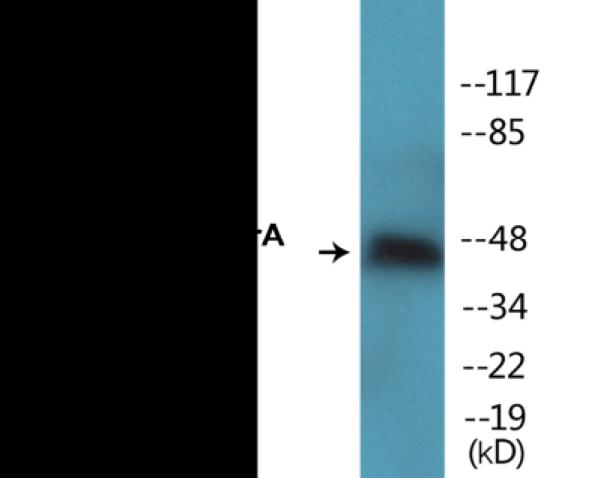 Western blot analysis of extracts from 293 cells treated with serum 20% 15 Western blot analysis of extracts from 293 cells treated with serum 20% 15