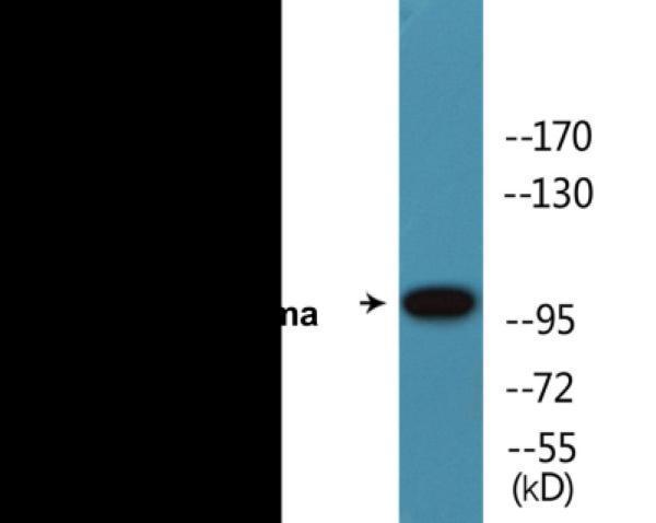 ekc2270 retinoblastoma phospho thr826 colorimetric cell based elisa kit wb testing 1