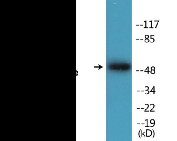 Western blot analysis of extracts from 293 cells treated with paclitaxel 1uM 24h