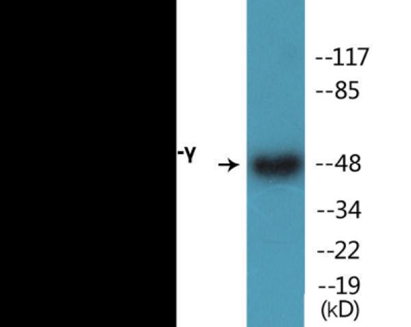 Western blot analysis of extracts from HepG2 cells treated with Anisomycin 0