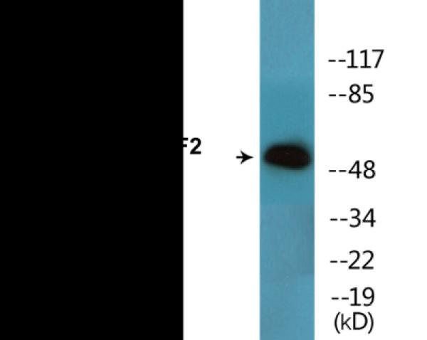 Western blot analysis of extracts from HeLa cells treated with UV