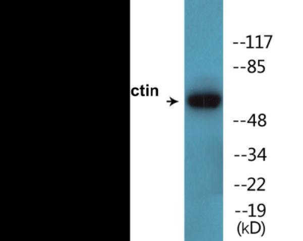 ekc2380 cortactin phospho tyr466 colorimetric cell based elisa kit wb testing 1
