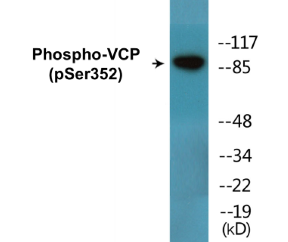 Western blot analysis of extracts from NIH-3T3 cells treated with starved 24h