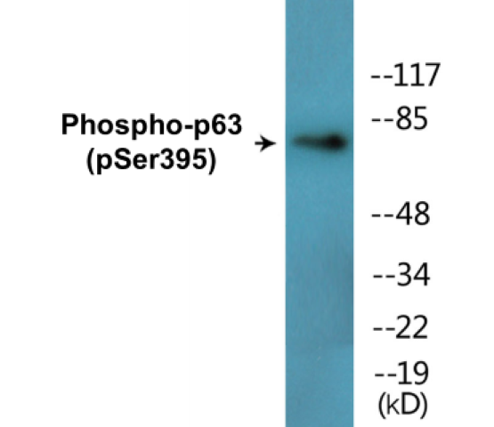 Western blot analysis of extracts from LOVO cells treated with nocodazole 1ug/ml 18h Western blot analysis of extracts from LOVO cells treated with nocodazole 1ug/ml 18h