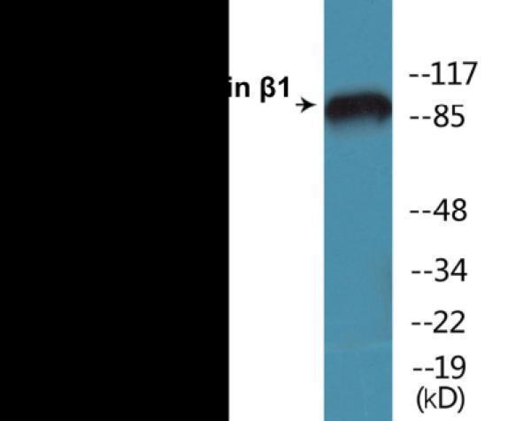 Western blot analysis of extracts from HeLa cells treated with UV 15