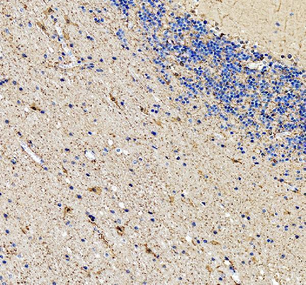 IHC analysis of ATP4A using anti-ATP4A antibody (A08198-1)