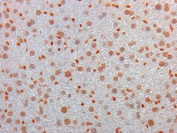 Immunohistochemistry of Mouse Monoclonal anti AKT3 Antibody in Mouse Embryonic Kidney