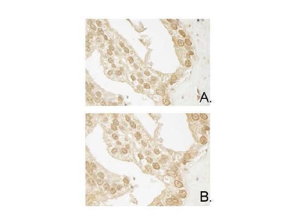f00520 akt3 primary antibodies ihc testing 3