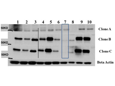 Western Blot of Mouse Anti-AKT3 antibody