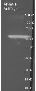 Western Blot of Goat Anti-ALPHA 1 ANTI TRYPSIN Antibody Lane 1: reduced Alpha-1anti-Trypsin