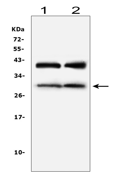 Western blot analysis of IGFBP1 using anti-IGFBP1 antibody (A00922-1). Electrophoresis was performed on a 5-20% SDS-PAGE gel at 70V (Stacking gel) / 90V (Resolving gel) for 2-3 hours. The sample well of each lane was loaded with 50ug of sample under reducing conditions. Lane 1: rat liver tissue lysates, Lane 2: mouse liver tissue lysates. After Electrophoresis, proteins were transferred to a Nitrocellulose membrane at 150mA for 50-90 minutes. Blocked the membrane with 5% Non-fat Milk/ TBS for 1.5 hour at RT. The membrane was incubated with rabbit anti-IGFBP1 antigen affinity purified polyclonal antibody (Catalog # A00922-1) at 0.5 μg/mL overnight at 4°C, then washed with TBS-0.1%Tween 3 times with 5 minutes each and probed with a goat anti-rabbit IgG-HRP secondary antibody at a dilution of 1:10000 for 1.5 hour at RT. The signal is developed using an Enhanced Chemiluminescent detection (ECL) kit (Catalog # EK1002) with Tanon 5200 system. A specific band was detected for IGFBP1 at approximately 30KD. The expected band size for IGFBP1 is at 28KD.