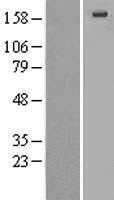 alpha 2 Macroglobulin (A2M) Human Over-expression Lysates NM_000014