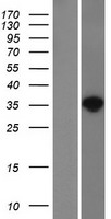 NAT1 Human Over-expression Lysates NM_000662
