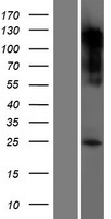 ls000015 serotonin n acetyltransferase aanat human over expression lysates nm 001088 wb testing 1