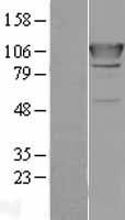 AlaRS (AARS) Human Over-expression Lysates NM_001605