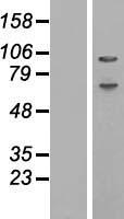 ABCF1 Human Over-expression Lysates NM_001025091