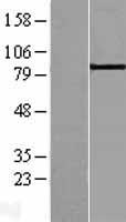 ABP1 (AOC1) Human Over-expression Lysates NM_001091
