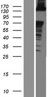 ABL2 Human Over-expression Lysates NM_007314