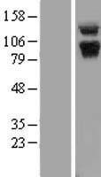 ls000029 abr human over expression lysates nm 021962 wb testing 1