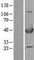 ls000030 acaa1 human over expression lysates nm 001607 wb testing 1
