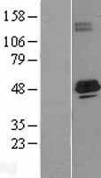 ls000035 acads human over expression lysates nm 000017 wb testing 1