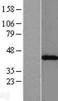 ls000039 acat2 human over expression lysates nm 005891 wb testing 1