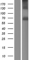 Acetylcholinesterase (ACHE) Human Over-expression Lysates NM_000665