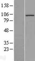 Aconitase 1 (ACO1) Human Over-expression Lysates NM_002197