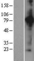 ls000050 aconitase 2 aco2 human over expression lysates nm 001098 wb testing 1