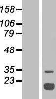 Acid Phosphatase (ACP1) Human Over-expression Lysates NM_004300