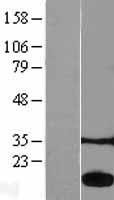 Acid Phosphatase (ACP1) Human Over-expression Lysates NM_007099