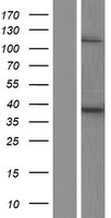 ls000054 tartrate resistant acid phosphatase acp5 human over expression lysates nm 001111034 wb testing 2