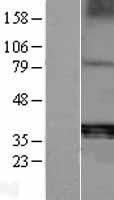 ls000054 tartrate resistant acid phosphatase acp5 human over expression lysates nm 001111036 wb testing 3