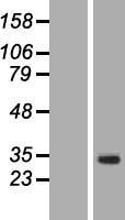 ACRV1 Human Over-expression Lysates NM_020069