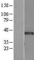 ls000070 actc1 human over expression lysates nm 005159 wb testing 1