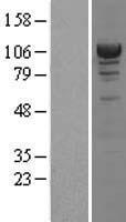 alpha Actinin 4 (ACTN4) Human Over-expression Lysates NM_004924