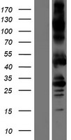 Activin Receptor Type IA (ACVR1) Human Over-expression Lysates NM_001105