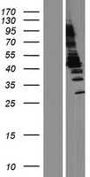 ls000095 aminoacylase 1 acy1 human over expression lysates nm 001198896 wb testing 1
