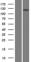 Adenylate cyclase 1 (ADCY1) Human Over-expression Lysates NM_021116